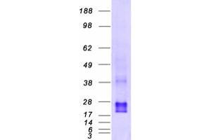 Validation with Western Blot