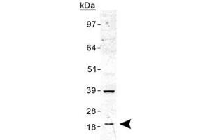 Western blot analysis of TMED10 in human liver lysate with TMED10 polyclonal antibody . (TMED10 anticorps  (AA 50-150))