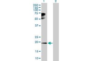 Western Blot analysis of TPRKB expression in transfected 293T cell line by TPRKB MaxPab polyclonal antibody. (TPRKB anticorps  (AA 1-175))