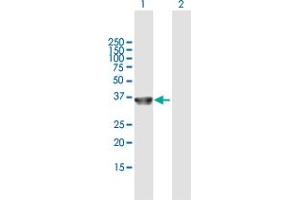 Western Blot analysis of COL23A1 expression in transfected 293T cell line by COL23A1 MaxPab polyclonal antibody.