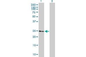 anti-RAB11B, Member RAS Oncogene Family (RAB11B) (AA 1-218) antibody