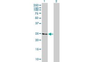 Western Blot analysis of RAB11B expression in transfected 293T cell line by RAB11B MaxPab polyclonal antibody. (RAB11B anticorps  (AA 1-218))