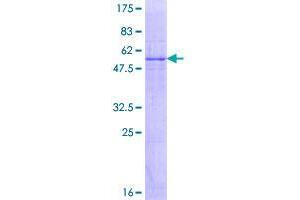 Image no. 1 for Glycerol Kinase 5 (Putative) (GK5) (AA 1-301) protein (GST tag) (ABIN1355162)