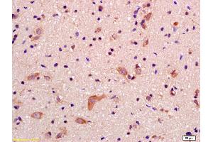 Formalin-fixed and paraffin embedded rat brain labeled with Anti-GRID2IP Polyclonal Antibody, Unconjugated (ABIN1386525) at 1:200 followed by conjugation to the secondary antibody and DAB staining