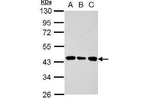 WB Image Sample (30 ug of whole cell lysate) A: 293T B: A431 C: HeLa 10% SDS PAGE antibody diluted at 1:1000 (ALDOB anticorps)