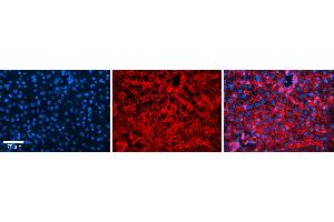 Rabbit Anti-CD81 Antibody Catalog Number: ARP63231_P050 Formalin Fixed Paraffin Embedded Tissue: Human Liver Tissue Observed Staining: Cytoplasm and plasma membrane in hepatocytes and endothelial cells in sinusoids Primary Antibody Concentration: 1:100 Other Working Concentrations: 1:600 Secondary Antibody: Donkey anti-Rabbit-Cy3 Secondary Antibody Concentration: 1:200 Magnification: 20X Exposure Time: 0.