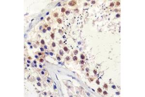 IHC testing of FFPE human testis tissue with TBP antibody at 1:25 dilution. (TBP anticorps)