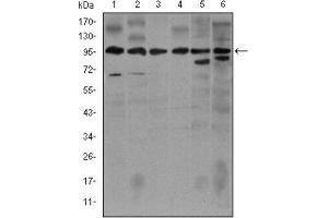 Western blot analysis using NOS2 antibody against Jurkat (1), Jurkat (2), A549 (3), HeLa (4), NIH3T3 (5) and MCF-7 (6) cell lysate.