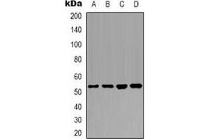 Western blot analysis of PTEN expression in Hela (A), MCF7 (B), NIH3T3 (C), mouse brain (D) whole cell lysates. (PTEN anticorps  (C-Term))