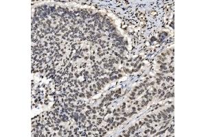 IHC analysis of DBC-1/CCAR2 using anti-DBC-1/CCAR2 antibody (ABIN7602235). (CCAR2 anticorps  (AA 65-917))