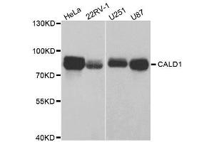 Western blot analysis of extracts of various cell lines, using CALD1 antibody. (Caldesmon anticorps  (AA 1-240))