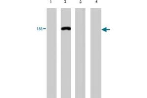 Western blot analysis of extract from red sea bream (lane 1), carp (lane 2), mummichog (lane 3) and medaka (lane 4), using Vitellogenin monoclonal antibody, clone 1G2 . (Vitellogenin 2 anticorps)
