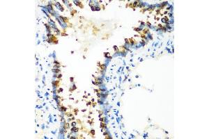 Immunohistochemistry of paraffin-embedded rat lung using MT-CO2 antibody. (COX2 anticorps)