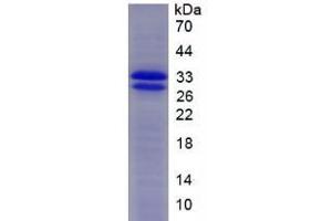SDS-PAGE analysis of Mouse SOD3 Protein. (SOD3 Protéine)