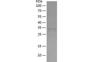 Western Blotting (WB) image for Ribosomal Protein S6 Kinase, 90kDa, Polypeptide 3 (RPS6KA3) (AA 666-740) protein (His-IF2DI Tag) (ABIN7124905)