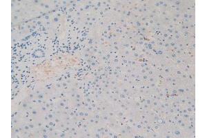 Figure. (SIRPA anticorps  (AA 105-324))