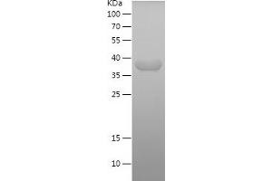 Western Blotting (WB) image for Caldesmon 1 (CALD1) (AA 1-250) protein (His tag) (ABIN7122098)