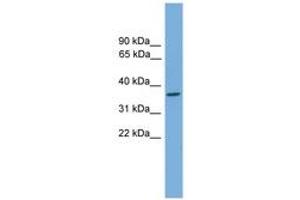 Image no. 1 for anti-General Transcription Factor IIH, Polypeptide 3, 34kD (GTF2H3) (AA 71-120) antibody (ABIN6744650)