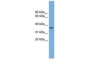 Image no. 1 for anti-General Transcription Factor IIH, Polypeptide 3, 34kD (GTF2H3) (AA 71-120) antibody (ABIN6744650) (GTF2H3 anticorps  (AA 71-120))