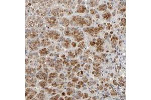 Immunohistochemical staining of human adrenal gland with C14orf119 polyclonal antibody  shows strong cytoplasmic positivity in cortical cells. (C14ORF119 anticorps)