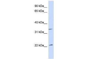 Western Blot showing ARF1 antibody used at a concentration of 1. (ARF1 anticorps  (Middle Region))