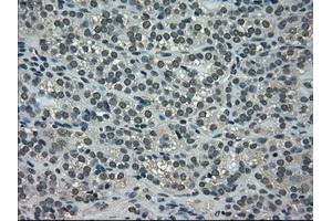 Immunohistochemical staining of paraffin-embedded Ovary tissue using anti-NEK6mouse monoclonal antibody. (NEK6 anticorps)