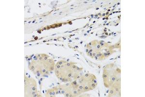 Immunohistochemistry of paraffin-embedded human stomach using MB21D1 antibody. (C6orf150 anticorps)
