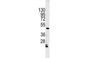 Western blot analysis of Integrin linked kinase antibody and HL-60 cell lysate. (ILK anticorps  (AA 11-41))
