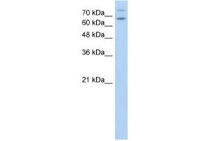 WB Suggested Anti-TSHR Antibody Titration:  0.