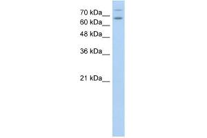 WB Suggested Anti-TSHR Antibody Titration:  0. (TSH receptor anticorps  (N-Term))