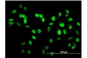 Immunofluorescence (IF) image for anti-Sirtuin 1 (SIRT1) (AA 456-555) antibody (ABIN614713)