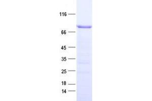 Validation with Western Blot