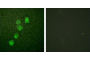 Peptide - +Immunofluorescence analysis of HuvEc cells, using Cyclin(Ab-395) antibody (#B0069). (Cyclin E1 anticorps  (Thr395))