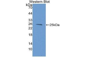Western Blotting (WB) image for anti-Proteasome (Prosome, Macropain) Subunit, beta Type, 9 (Large Multifunctional Peptidase 2) (PSMB9) (AA 22-219) antibody (ABIN1980450) (PSMB9 anticorps  (AA 22-219))