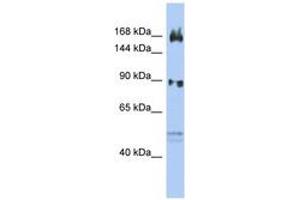 Image no. 1 for anti-AF4/FMR2 Family, Member 2 (AFF2) (N-Term) antibody (ABIN6742451) (AFF2 anticorps  (N-Term))