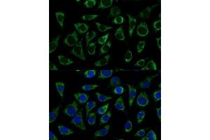 Immunofluorescence analysis of L929 cells using C1 Polyclonal Antibody (ABIN7265723) at dilution of 1:100 (40x lens).
