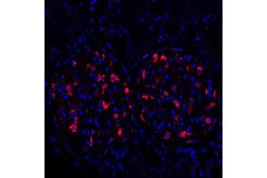 Immunofluorescence (IF) image for anti-Tight Junction Protein 1 (TJP1) (AA 650-700) antibody (ABIN7453989) (Recombinant TJP1 anticorps  (AA 650-700))