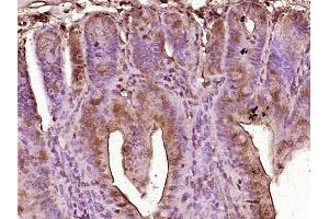 Paraformaldehyde-fixed, paraffin embedded mouse intestine tissue, Antigen retrieval by boiling in sodium citrate buffer (pH6.