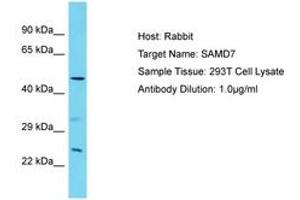 Image no. 1 for anti-Sterile alpha Motif Domain Containing 7 (SAMD7) (AA 175-224) antibody (ABIN6750794) (SAMD7 anticorps  (AA 175-224))