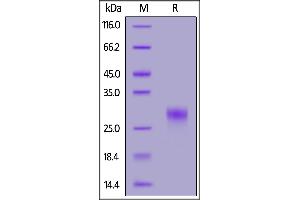 Human CD8 alpha, His Tag on  under reducing (R) condition.