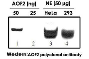 Western blot was performed using AOF2 polyclonal antibody  diluted 1 : 1,000 in TBS-Tween containing 5% skimmed milk. (LSD1 anticorps)