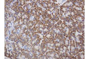 Image no. 4 for anti-Ribophorin II (RPN2) antibody (ABIN1500757)