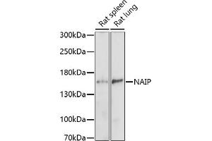 Western blot analysis of extracts of various cell lines, using NAIP antibody (ABIN7268932) at 1:1000 dilution. (NAIP anticorps  (AA 750-850))