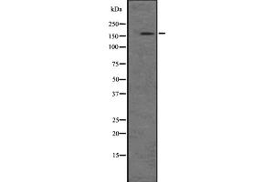 Western blot analysis of PIK3C2B expression in A-431 cell lysate at 25ug/lane.