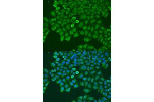 Immunofluorescence analysis of U2OS cells using CAST antibody (ABIN6290228) at dilution of 1:100. (Calpastatin anticorps)