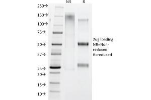 SDS-PAGE Analysis IgG4 Mouse Monoclonal Antibody (IGHG4/1345). (IGHG4 anticorps)
