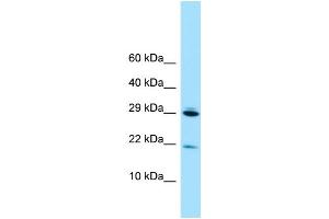 WB Suggested Anti-RPL28 Antibody Titration: 1. (RPL28 anticorps  (N-Term))