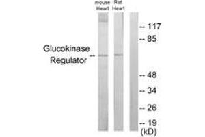 Western blot analysis of extracts from mouse heart/rat heart cells, using Glucokinase Regulator Antibody. (GCKR anticorps  (AA 211-260))