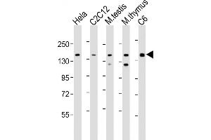 All lanes : Anti-Smarcc1 Antibody (C-term) at 1:2000 dilution Lane 1: Hela whole cell lysate Lane 2: C2C12 whole cell lysate Lane 3: mouse testis lysate Lane 4: mouse thymus lysate Lane 5: C6 whole cell lysate Lysates/proteins at 20 μg per lane.