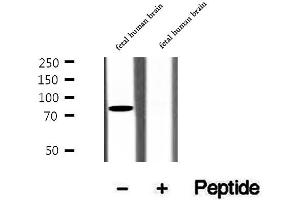 Western blot analysis of extracts of fetal human brain tissue, using CIN85 antibody.